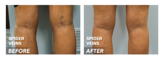 Before and after photo - 2