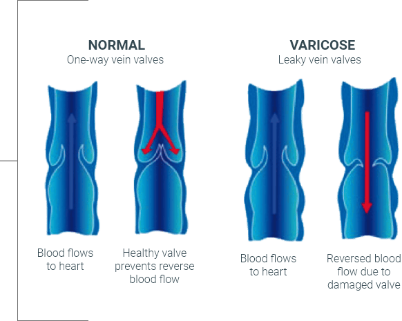 Veins Anatomy 2