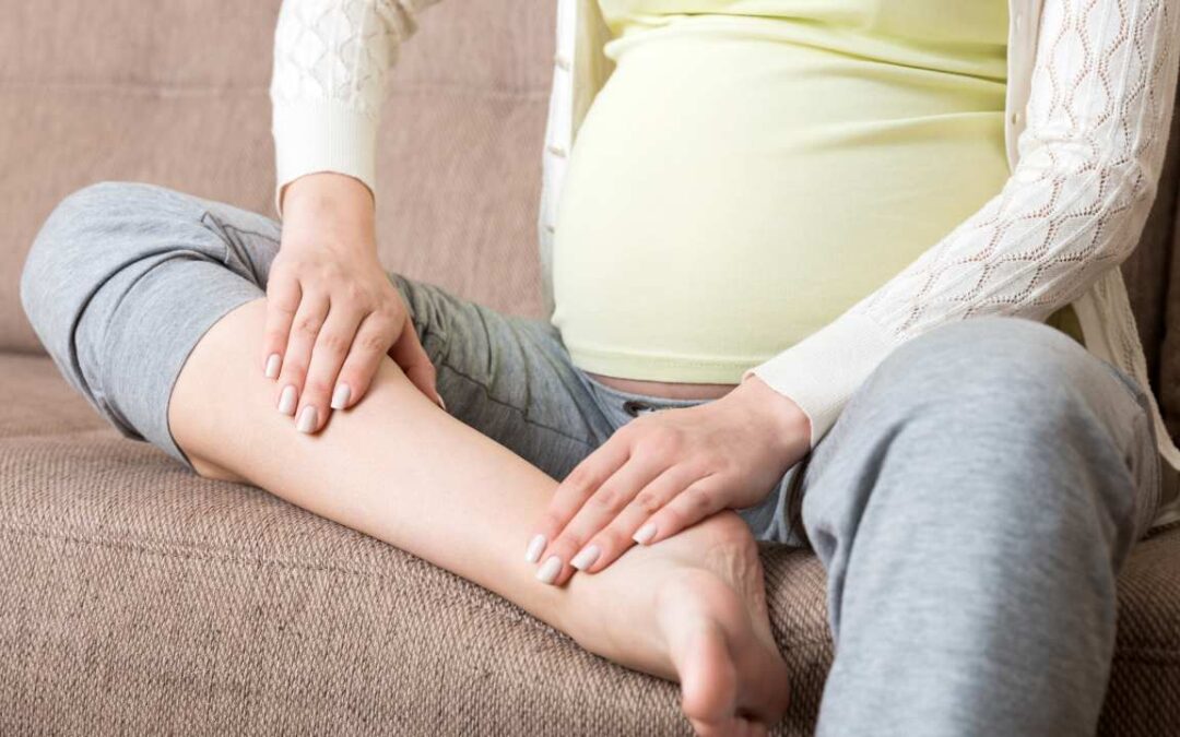Do Varicose Veins Go Away After Pregnancy? Find Out Today!