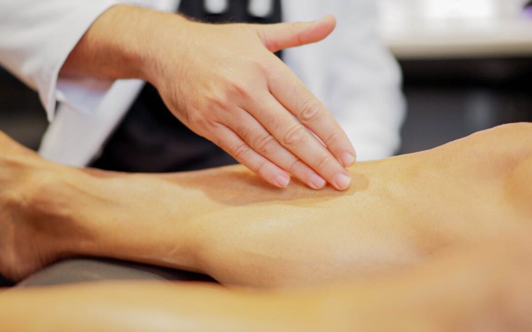 Top Treatments for Spider Veins in National City, CA
