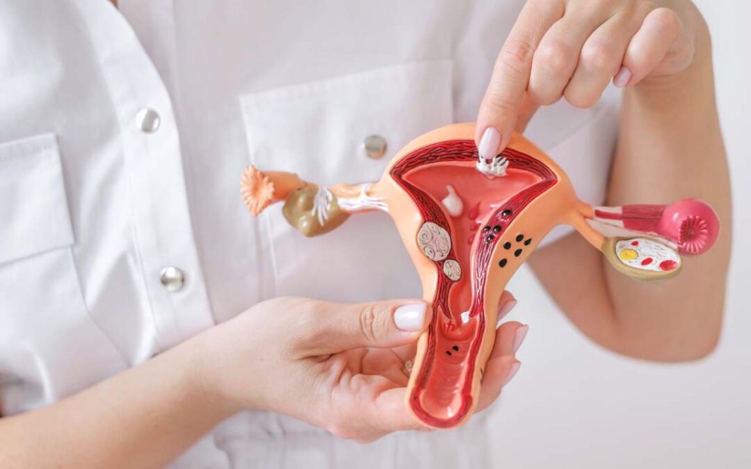Uterine Fibroid Embolization (UFE): What You Need to Know