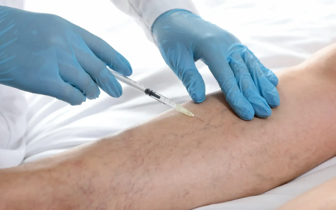 Who is the best vein doctor in Astoria, NY?