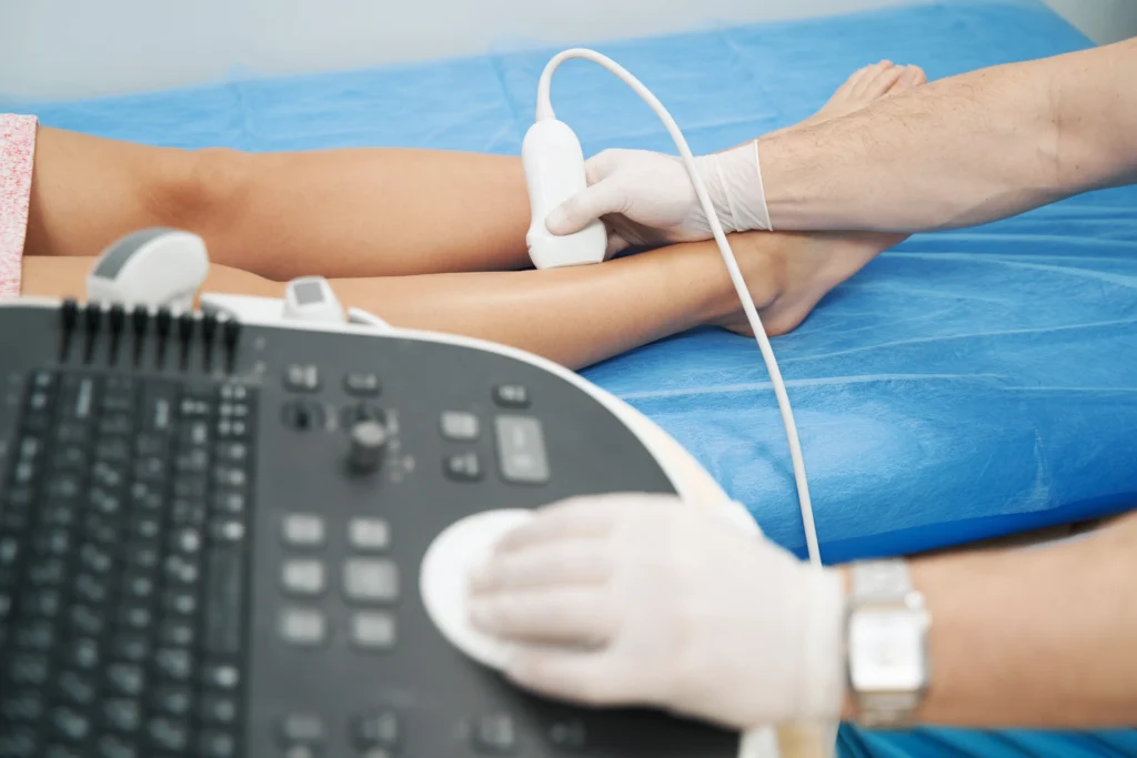 Dr. Tyson Can Provide the Best Treatment for Spider Veins in Hamden, CT