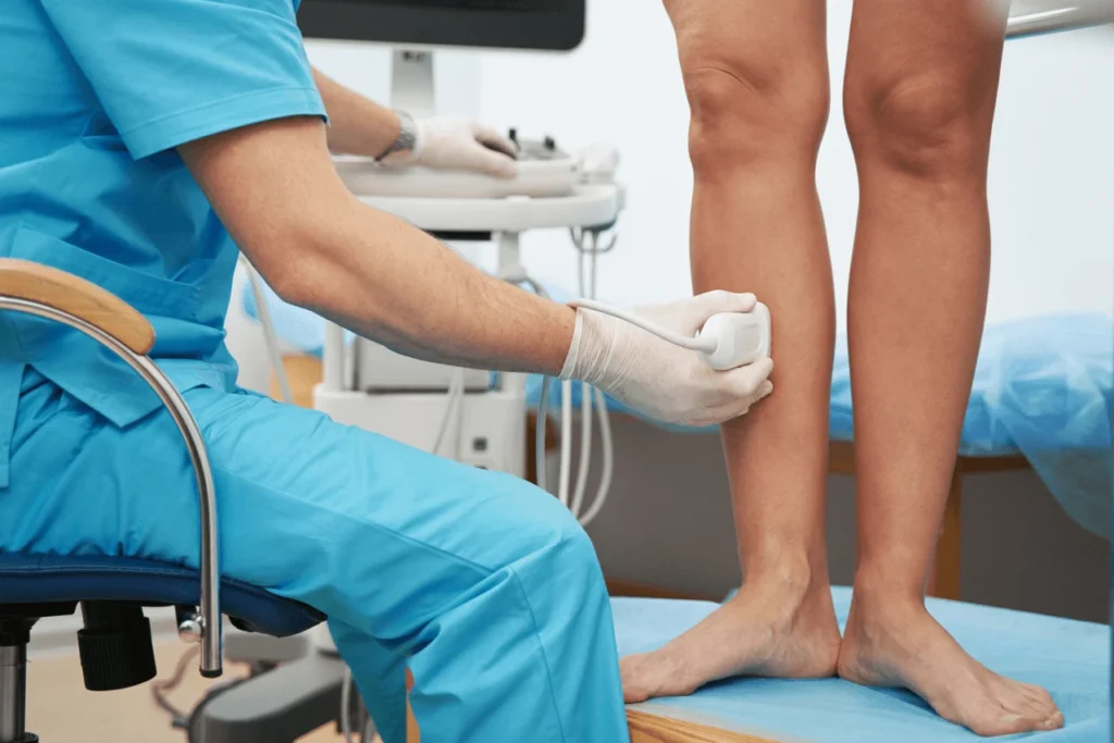 Find the Best Varicose Vein Doctors in Kyle, TX