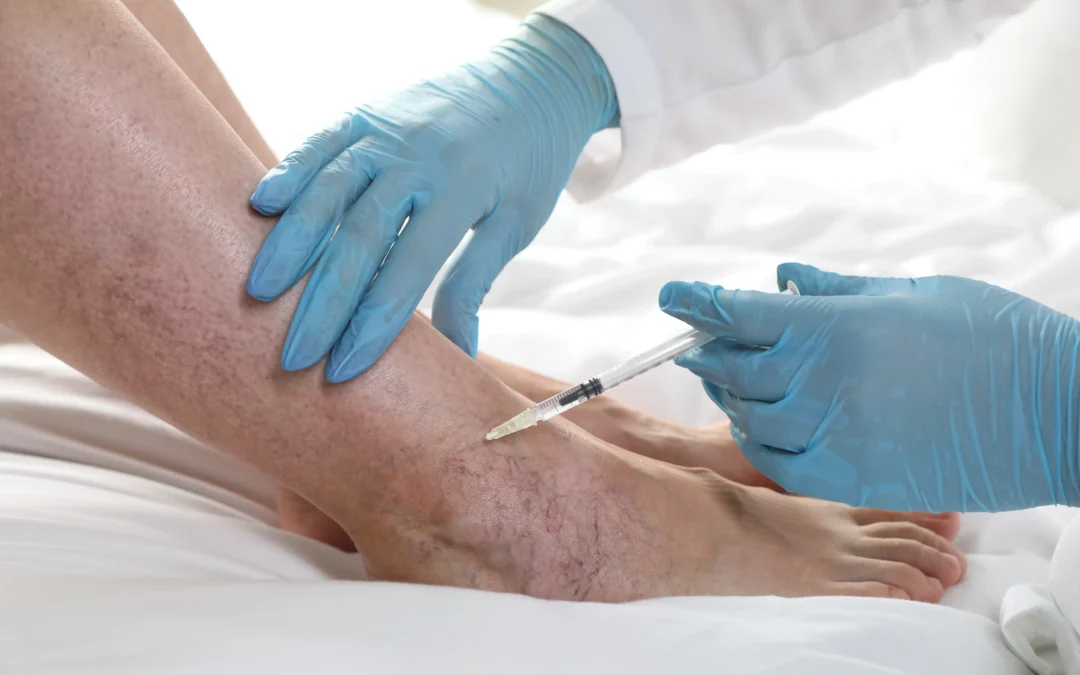 Who is the best doctor for sclerotherapy in Astoria?
