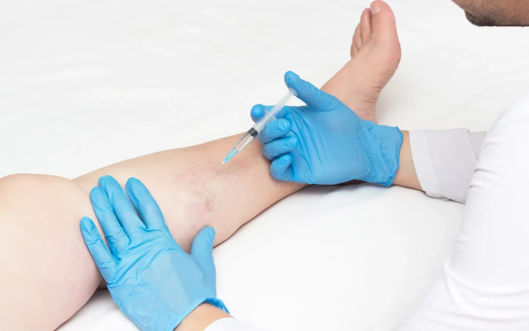 Who is the best doctor for spider veins in Astoria?