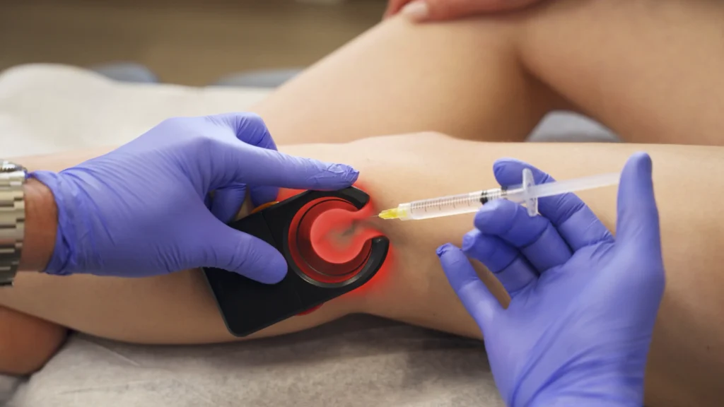 Vein Doctor in Fort Worth, Texas for Spider Vein Treatment