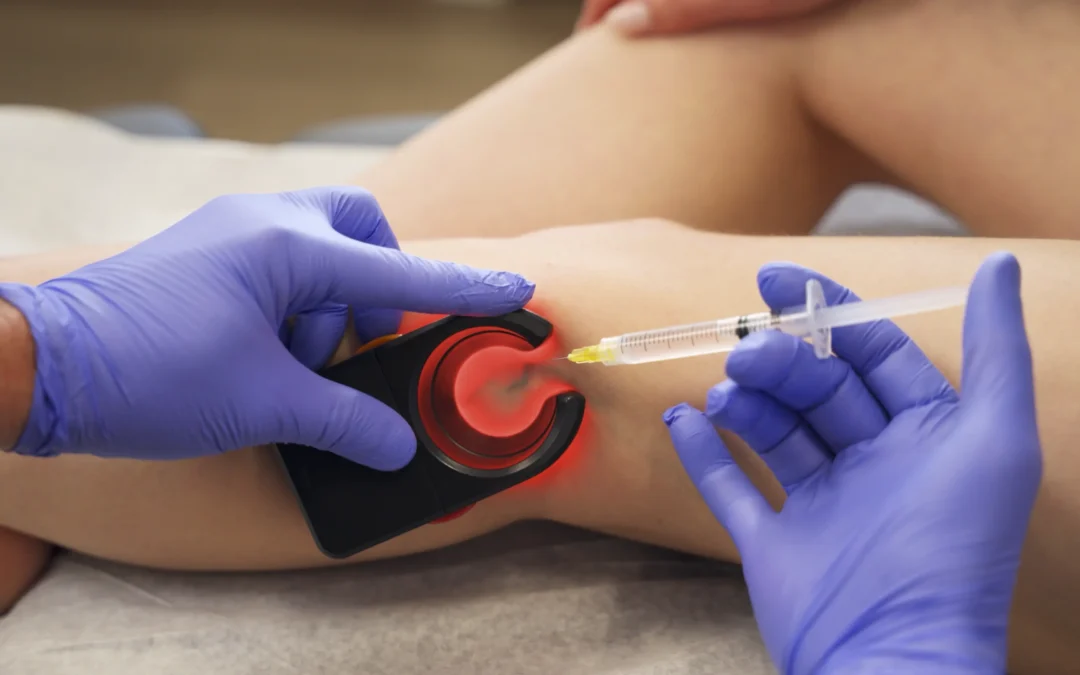 Vein Doctor in Fort Worth, Texas for Spider Vein Treatment