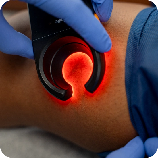 Double certified Dr Kamran Saraf A healthcare provider wearing pink gloves is using a Veinlite device on a patient's skin to visualize vein patterns for venous assessment. The device emits bright red and yellow light that illuminates superficial veins, commonly used in the evaluation of Varicose Veins, Spider Veins, and Chronic Venous Insufficiency. This diagnostic technique aids in vein mapping procedures prior to potential interventions such as Sclerotherapy or Radiofrequency Ablation.